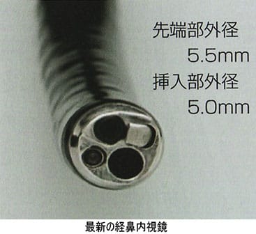 最新の経鼻内視鏡の先端部拡大画像