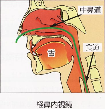 経鼻内視鏡