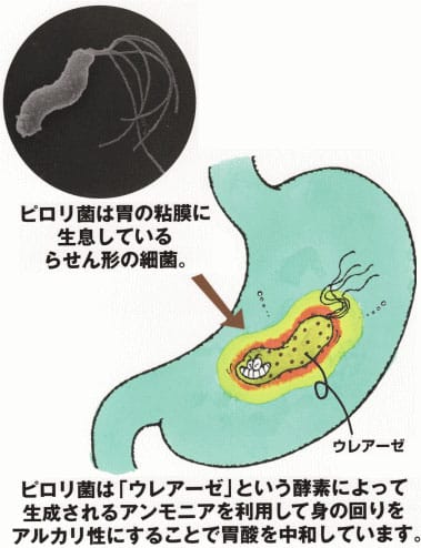 ピロリ菌（ヘリコバクター・ピロリ、Helicobacter pylori）とは